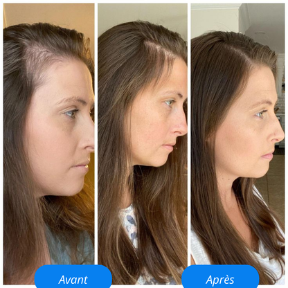 Revoria© Sérum Capillaire – Stimule la Pousse & Renforce les Cheveux