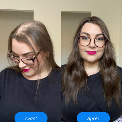 Revoria© Sérum Capillaire – Stimule la Pousse & Renforce les Cheveux