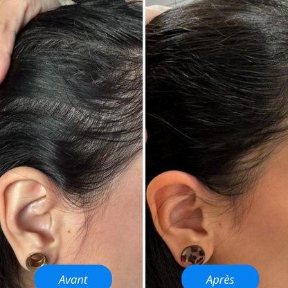 Revoria© Sérum Capillaire – Stimule la Pousse & Renforce les Cheveux