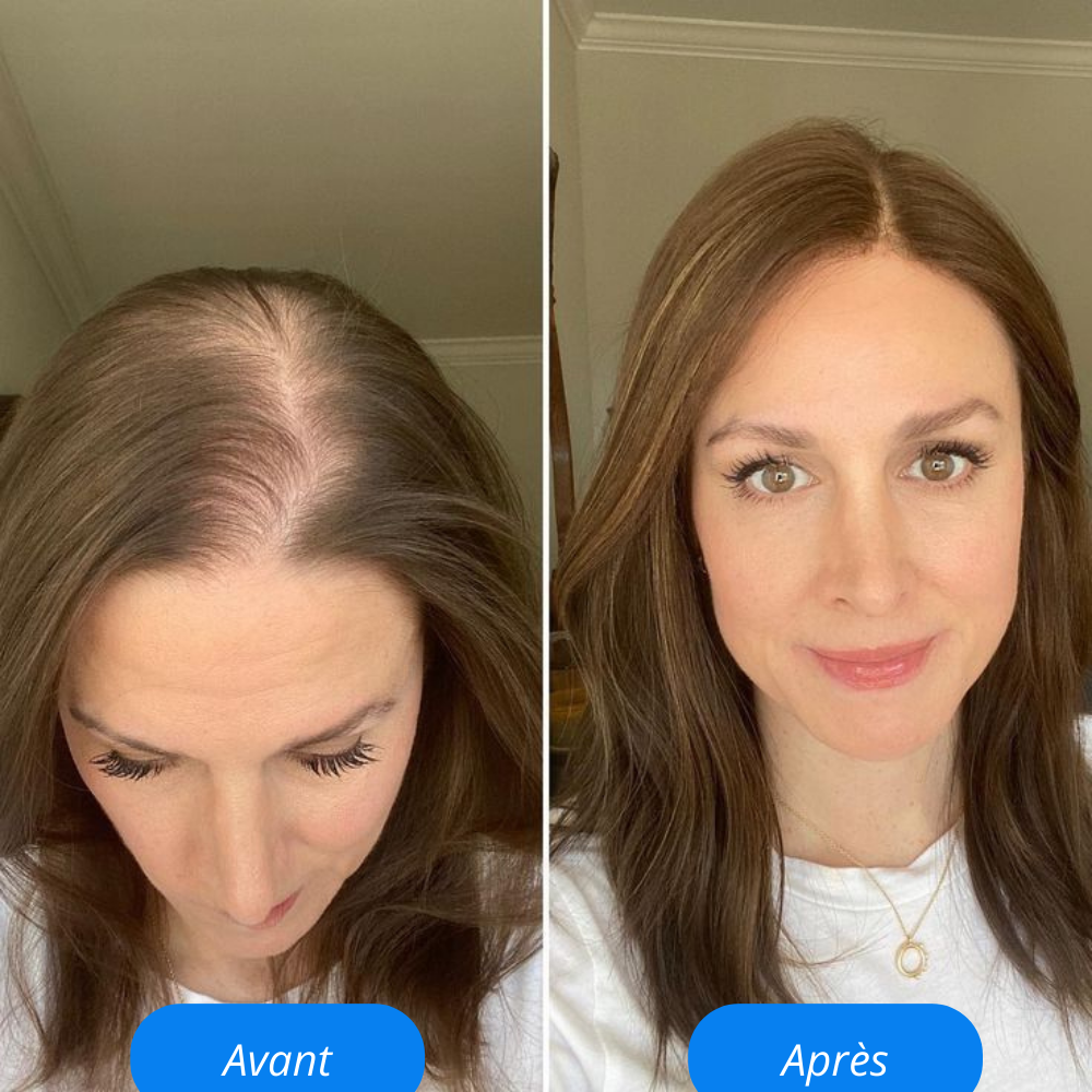 Revoria© Sérum Capillaire – Stimule la Pousse & Renforce les Cheveux